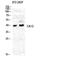 Carbonic anhydrase 12 antibody, GTX34128, GeneTex, Western Blot image 