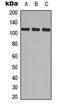 Integrin Subunit Alpha 2b antibody, MBS829378, MyBioSource, Western Blot image 