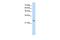 Troponin I1, Slow Skeletal Type antibody, GTX47077, GeneTex, Western Blot image 