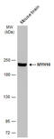 Myosin Heavy Chain 10 antibody, GTX634139, GeneTex, Western Blot image 