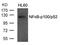 Nuclear Factor Kappa B Subunit 2 antibody, 79-266, ProSci, Western Blot image 