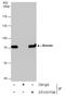Moesin antibody, GTX101708, GeneTex, Immunoprecipitation image 