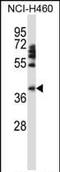 Forkhead Box D1 antibody, PA5-35145, Invitrogen Antibodies, Western Blot image 