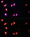 SET Domain Containing 2, Histone Lysine Methyltransferase antibody, GTX64431, GeneTex, Immunocytochemistry image 