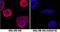 S100 Calcium Binding Protein A9 antibody, AF5578, R&D Systems, Immunocytochemistry image 
