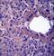 Lin-52 DREAM MuvB Core Complex Component antibody, LS-C165783, Lifespan Biosciences, Immunohistochemistry paraffin image 