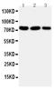 Growth Hormone Receptor antibody, PA1206, Boster Biological Technology, Western Blot image 