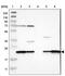 Signal Peptidase Complex Subunit 2 antibody, PA5-53052, Invitrogen Antibodies, Western Blot image 