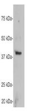 Growth Associated Protein 43 antibody, GTX30199, GeneTex, Western Blot image 