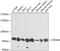 Zinc Finger Protein 408 antibody, 23-632, ProSci, Western Blot image 
