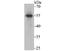 Golgi Associated PDZ And Coiled-Coil Motif Containing antibody, A03660-1, Boster Biological Technology, Western Blot image 