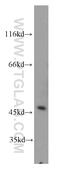 ArfGAP With FG Repeats 2 antibody, 11919-1-AP, Proteintech Group, Western Blot image 