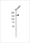 Myosin Binding Protein C, Cardiac antibody, 56-426, ProSci, Western Blot image 