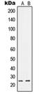 Ras Like Without CAAX 1 antibody, orb214518, Biorbyt, Western Blot image 