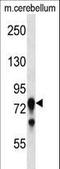 Protein Kinase C Gamma antibody, LS-C164550, Lifespan Biosciences, Western Blot image 