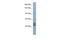 Testis Expressed 10 antibody, A09504, Boster Biological Technology, Western Blot image 