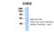 Chromodomain Helicase DNA Binding Protein 2 antibody, 25-199, ProSci, Western Blot image 