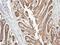 NADH:Ubiquinone Oxidoreductase Subunit A10 antibody, GTX103093, GeneTex, Immunohistochemistry paraffin image 