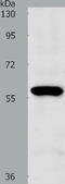 SLC5A1 antibody, TA324226, Origene, Western Blot image 