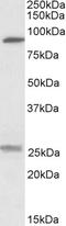 Solute Carrier Family 4 Member 11 antibody, EB09681, Everest Biotech, Western Blot image 