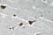 Serpin Family E Member 1 antibody, LS-C291727, Lifespan Biosciences, Immunohistochemistry paraffin image 