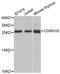 Cyclin Dependent Kinase Inhibitor 1B antibody, TA332381, Origene, Western Blot image 