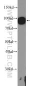 Glycogen Phosphorylase L antibody, 15851-1-AP, Proteintech Group, Western Blot image 