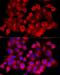 Clathrin Heavy Chain antibody, LS-C747528, Lifespan Biosciences, Immunofluorescence image 