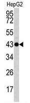 Actin Gamma 1 antibody, AP17084PU-N, Origene, Western Blot image 