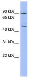 Zinc Finger Protein 569 antibody, TA337877, Origene, Western Blot image 