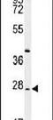 DIRAS Family GTPase 3 antibody, PA5-25785, Invitrogen Antibodies, Western Blot image 