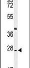 DIRAS Family GTPase 3 antibody, PA5-25785, Invitrogen Antibodies, Western Blot image 