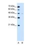 Solute Carrier Family 43 Member 3 antibody, NBP1-69535, Novus Biologicals, Western Blot image 