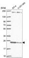 Transmembrane P24 Trafficking Protein 3 antibody, NBP2-57648, Novus Biologicals, Western Blot image 