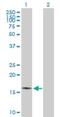 Mitochondrial Inner Membrane Protein MPV17 antibody, H00004358-B01P, Novus Biologicals, Western Blot image 