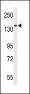 Reversion Inducing Cysteine Rich Protein With Kazal Motifs antibody, 63-860, ProSci, Western Blot image 