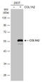 Collagen Type I Alpha 2 Chain antibody, GTX102996, GeneTex, Western Blot image 