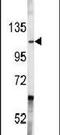 ABL Proto-Oncogene 1, Non-Receptor Tyrosine Kinase antibody, PA5-14762, Invitrogen Antibodies, Western Blot image 