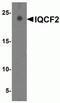 IQ Motif Containing F2 antibody, NBP2-81922, Novus Biologicals, Western Blot image 