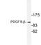 Platelet Derived Growth Factor Receptor Beta antibody, LS-C177665, Lifespan Biosciences, Western Blot image 