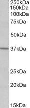 Sphingosine-1-Phosphate Receptor 2 antibody, EB10252, Everest Biotech, Western Blot image 