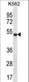 Apolipoprotein B MRNA Editing Enzyme Catalytic Subunit 3G antibody, LS-C159095, Lifespan Biosciences, Western Blot image 