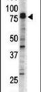 Doublecortin Like Kinase 1 antibody, PA5-14046, Invitrogen Antibodies, Western Blot image 