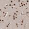 Protein Phosphatase 1 Regulatory Subunit 8 antibody, NBP1-90111, Novus Biologicals, Immunohistochemistry paraffin image 