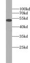 TRNA Methyltransferase 11 Homolog antibody, FNab09005, FineTest, Western Blot image 