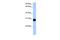 SLAM Family Member 6 antibody, GTX45894, GeneTex, Western Blot image 