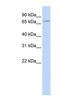 Solute Carrier Family 5 Member 5 antibody, NBP1-62517, Novus Biologicals, Western Blot image 