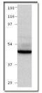 Bone Morphogenetic Protein Receptor Type 2 antibody, PA1-31215, Invitrogen Antibodies, Western Blot image 