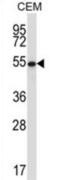 GA Binding Protein Transcription Factor Subunit Alpha antibody, abx027758, Abbexa, Western Blot image 