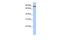 Transmembrane Protein 63A antibody, GTX47317, GeneTex, Western Blot image 